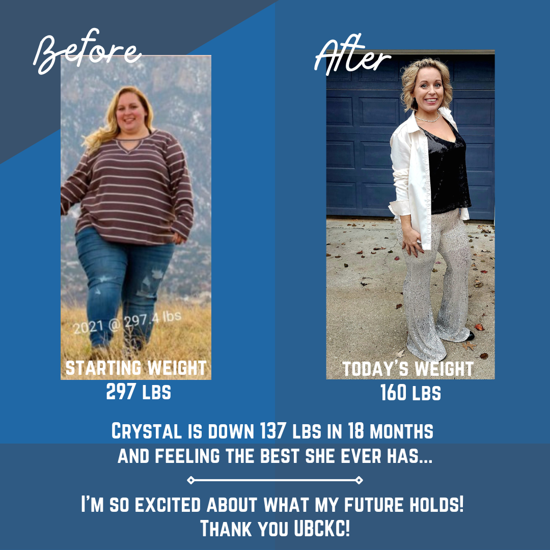 Bariatric surgery patient before & after photos