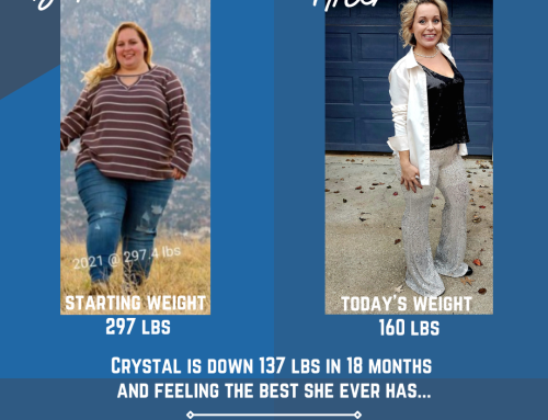 What to Expect From Gastric Sleeve Surgery After 3 Months
