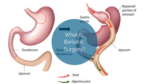 graphic showing the human stomach organs
