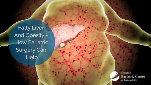Transparent view of obese person and their fatty liver