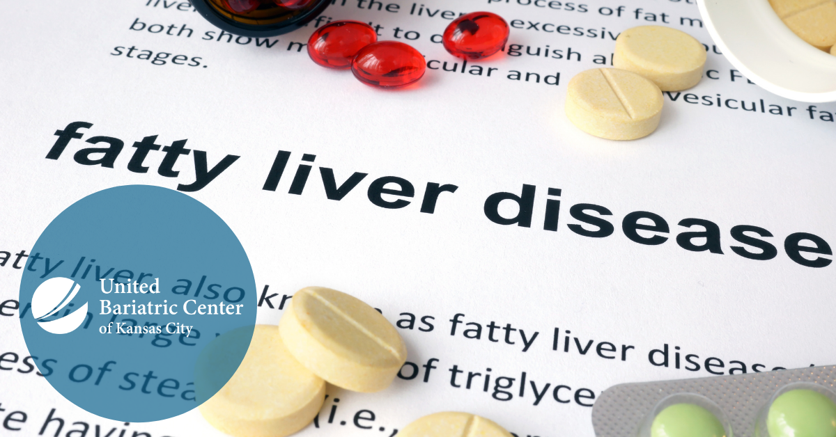 Weight loss pills and the definition of fatty liver disease